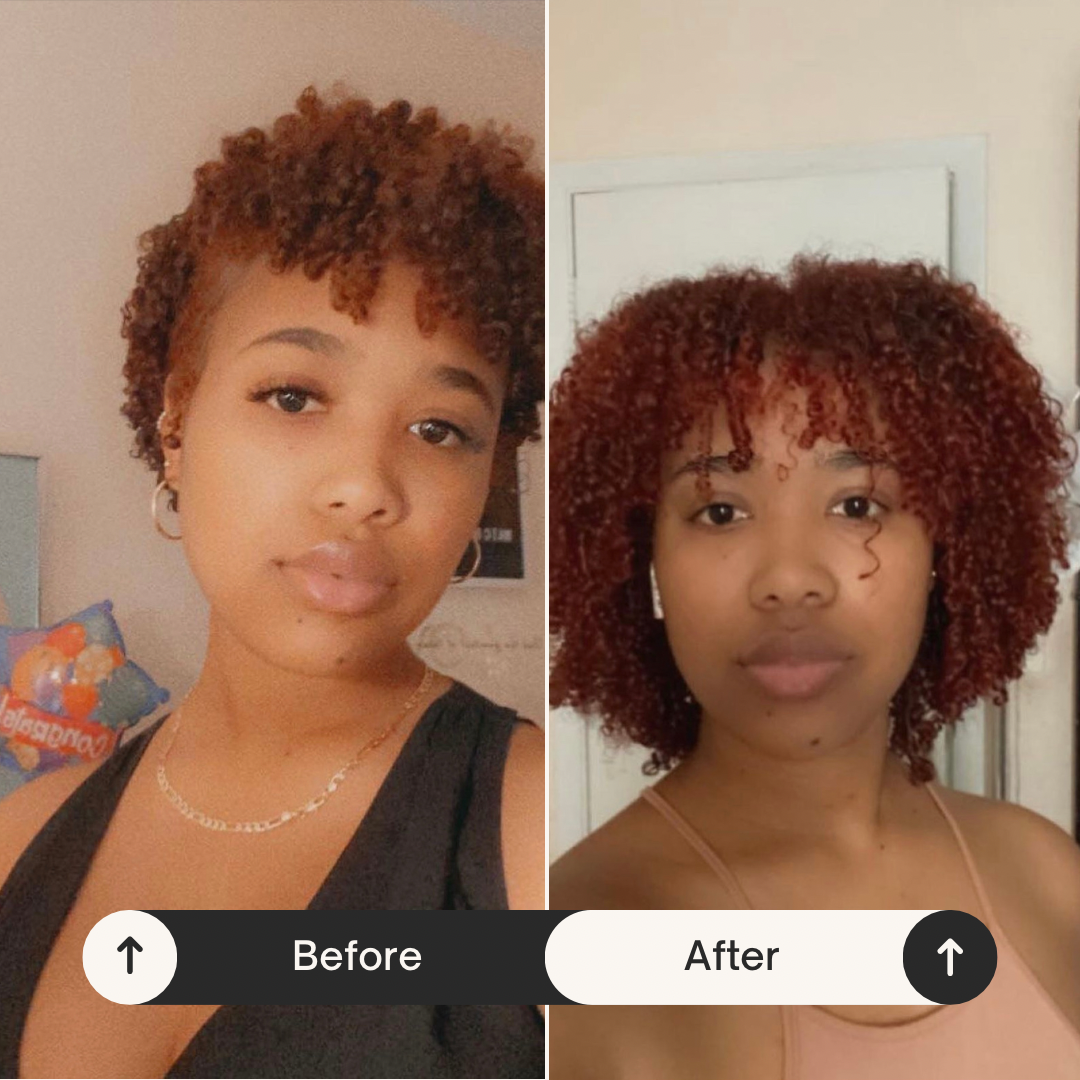 Organic Growth Serum